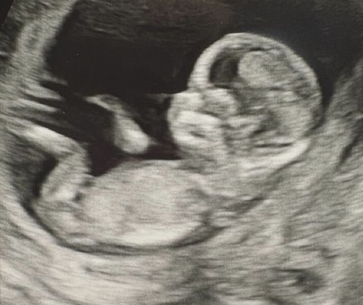 Due February 2026 - thread 2