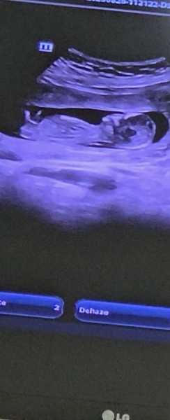 13+3 nub theory!?