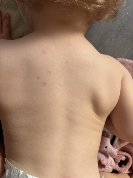 Anyone have any idea about these spots?