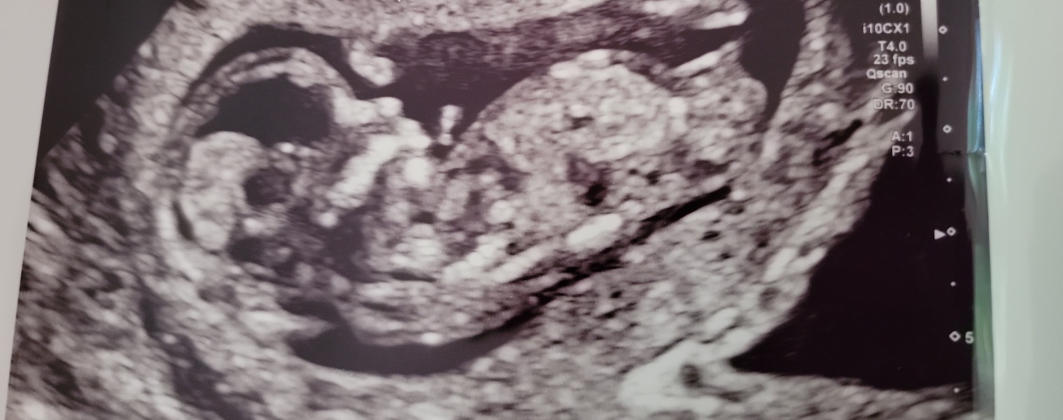 Due February 2026 - thread 2