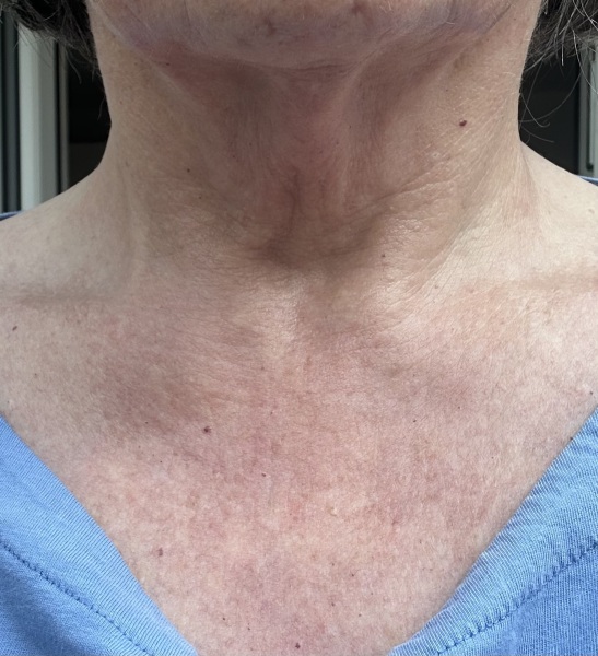 Ageing neck - what do you use?