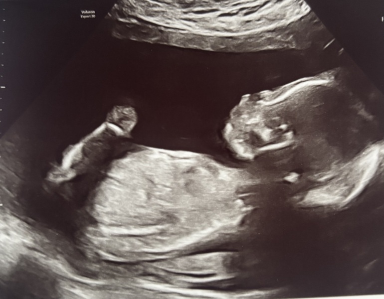 Due January 2026 - thread 2
