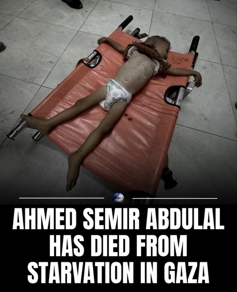 Gaza starving to death. USA & UK need to rise up