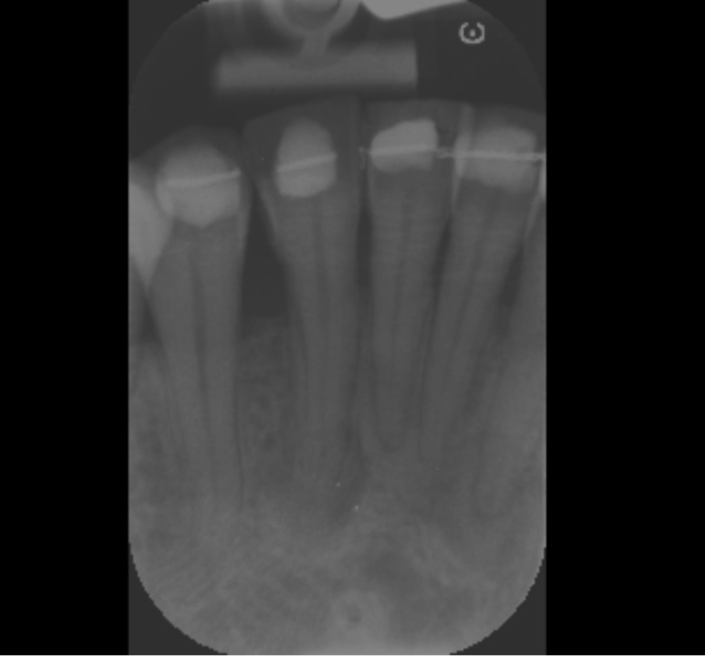 Any dentists/endodontist here that could help me?