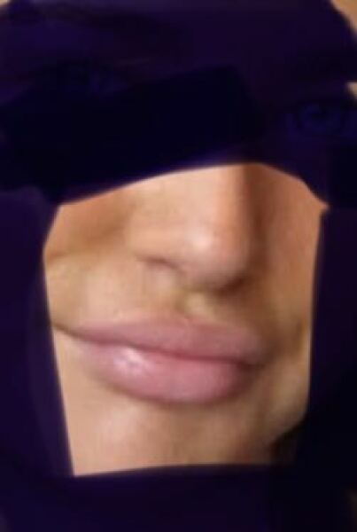 To wonder what’s going on with all the big lips