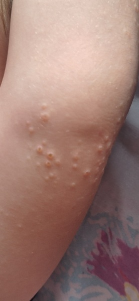 What are these spots?