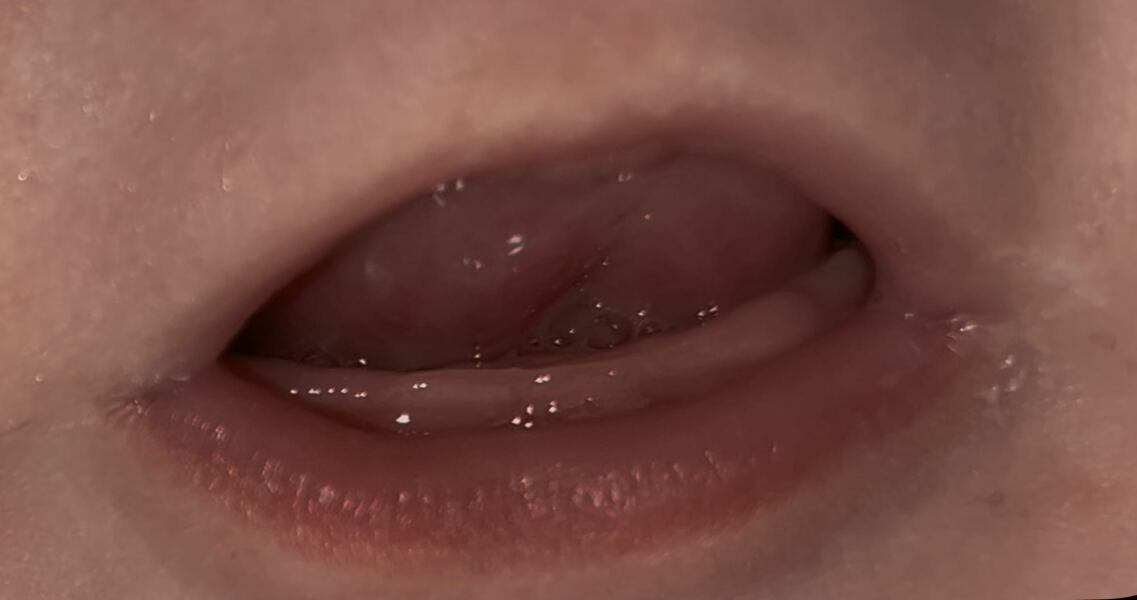 Is my baby teething?