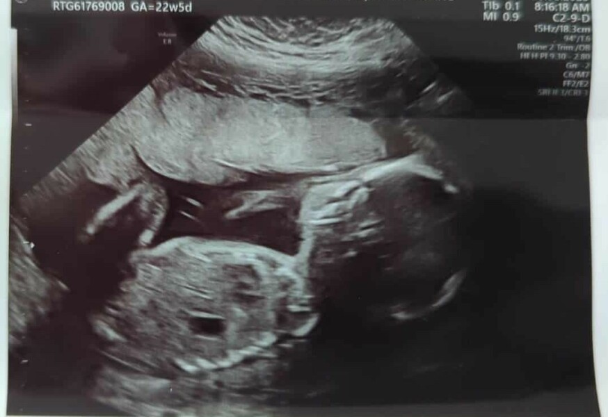 Due December 2025