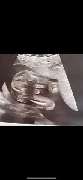 Potty shot confirmation