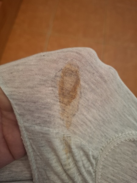 Should I be worried? Very slight brown/reddish discharge 33 weeks pregnant. *warning pic in comments!!*