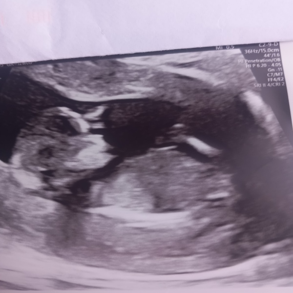 Boy or Girl?