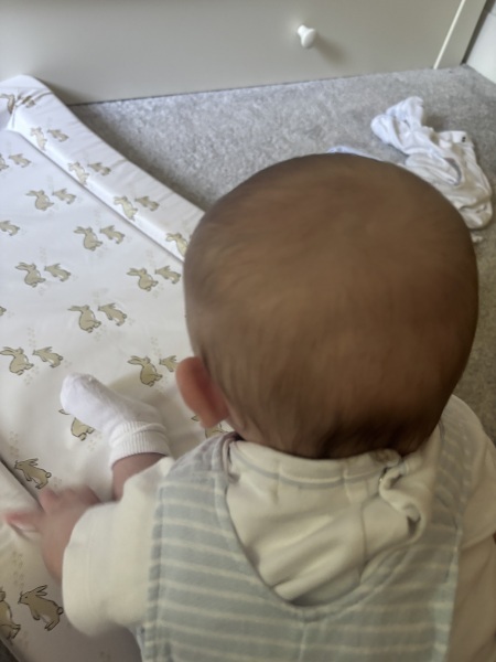 Four-month-old’s head