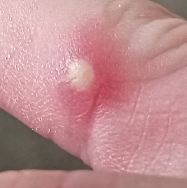 What is this!!!!????