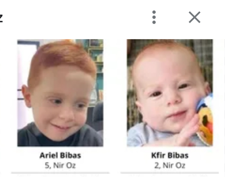 5 year old Jude Shalabi sustained a skull fracture after settlers threw stones at him near Shomrom settlement in the occupied West Bank