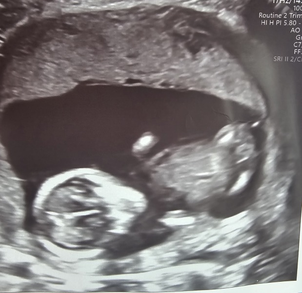 Can you guess the gender?