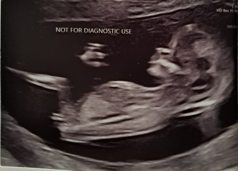 Due February 2026 - thread 2