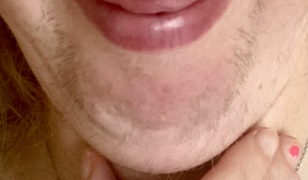 How bad is it