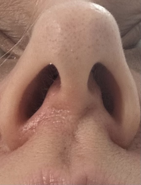 Do I have a deviated septum?