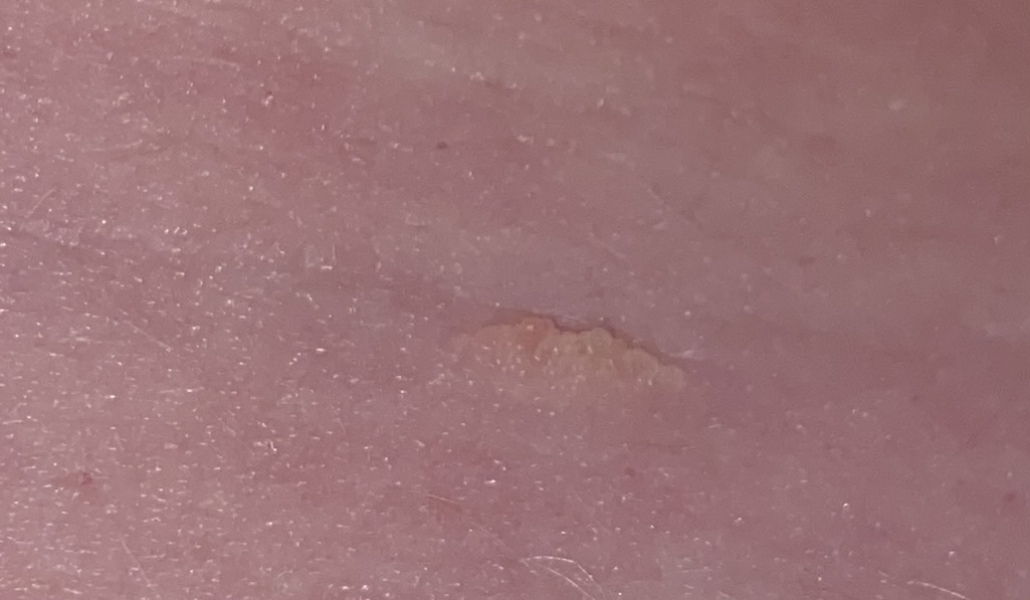Strange mole/growth/skin tag?