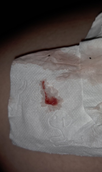 I think I've had a miscarriage