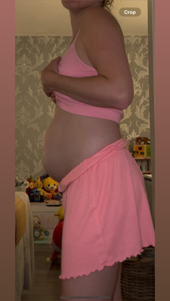 Belly looks abnormal