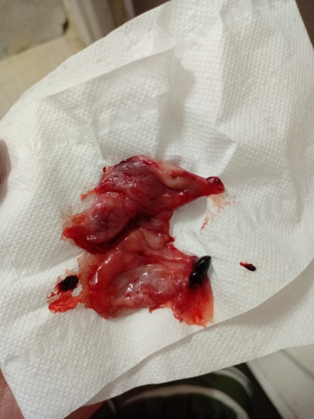 Please help - is this a miscarriage?