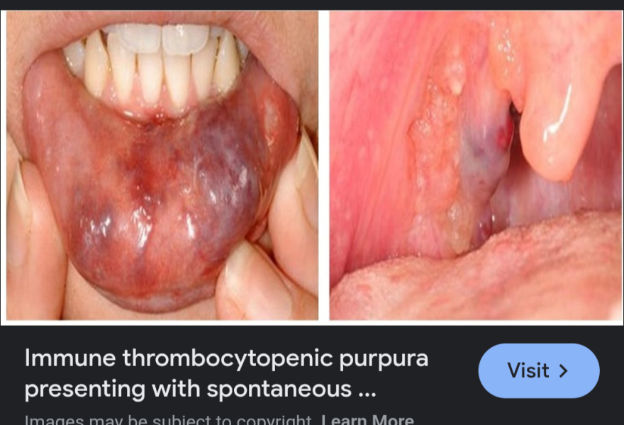 Temporary blue purple lips