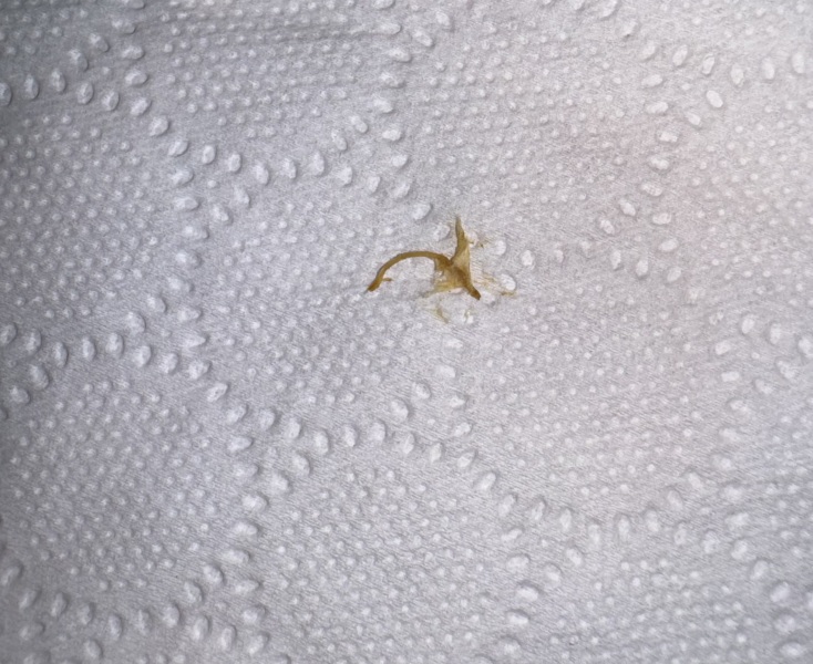 (TMI) included pic! Is this a threadworm