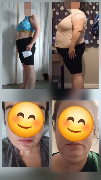 Anyone want to share their before and after pics?