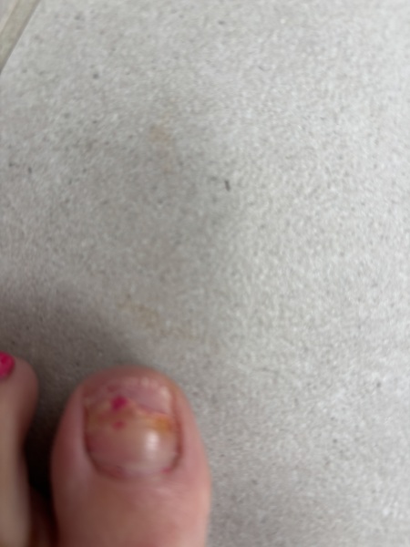 Fake toe nails - help!