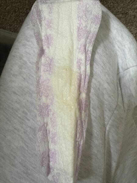 Am I leaking amniotic fluid?
