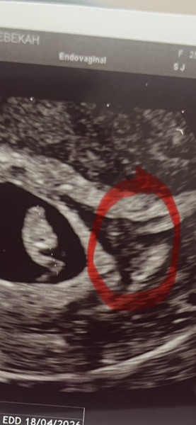 Does this look like two babies?