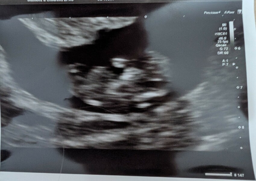 Due March 2026 🤍 pt 2