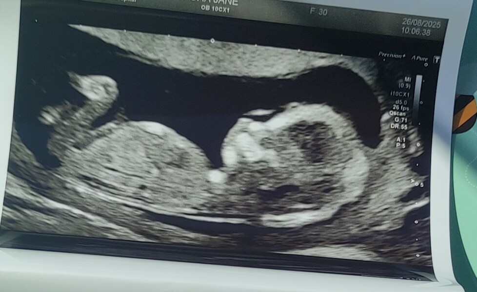 Boy or girl