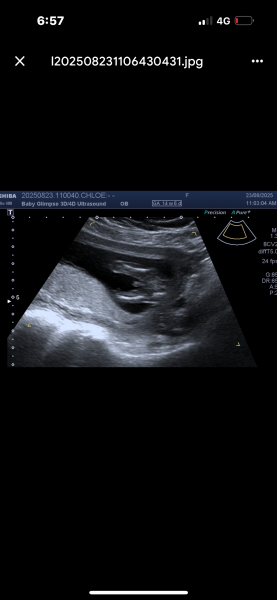 Is this a boy or girl