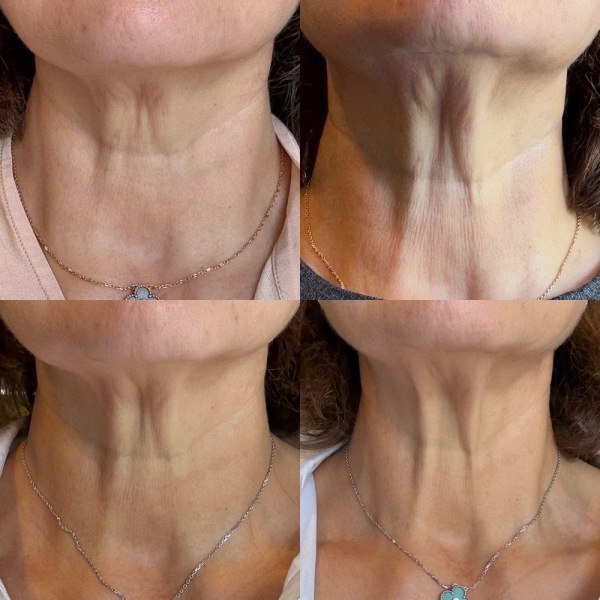 January Starters - Thread 11!