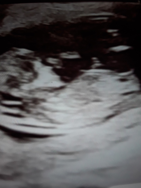 Surely this is a baby boy