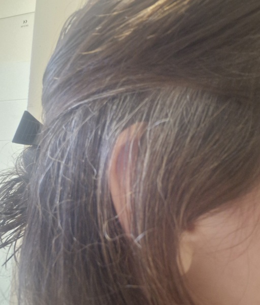 To be this grey at 35?