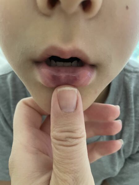 Temporary blue purple lips