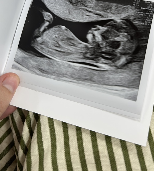 Boy or girl