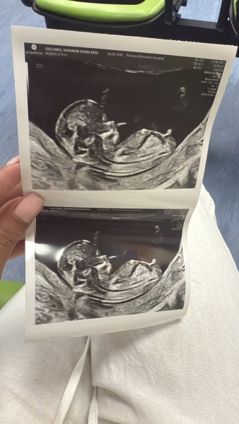 Has anyone had nub theory be wrong?