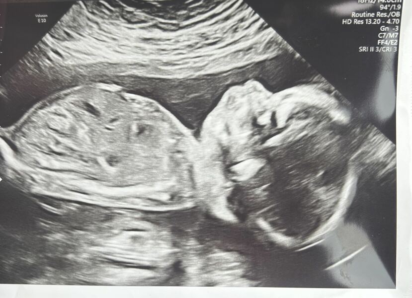 Due January 2026 - thread 2