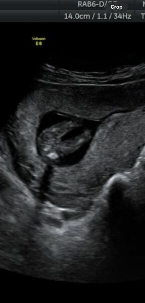 Potty shot - boy or girl? 🩵🩷