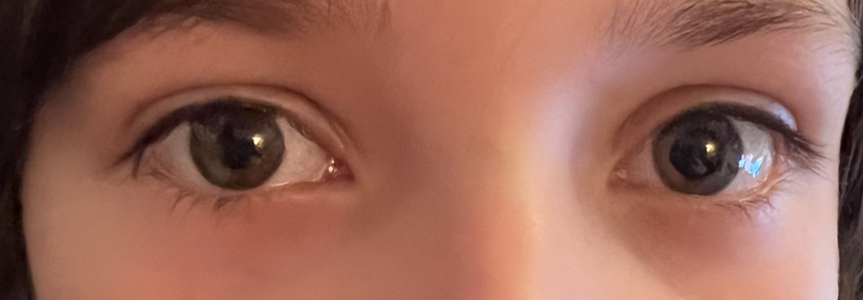 What colour are these eyes?