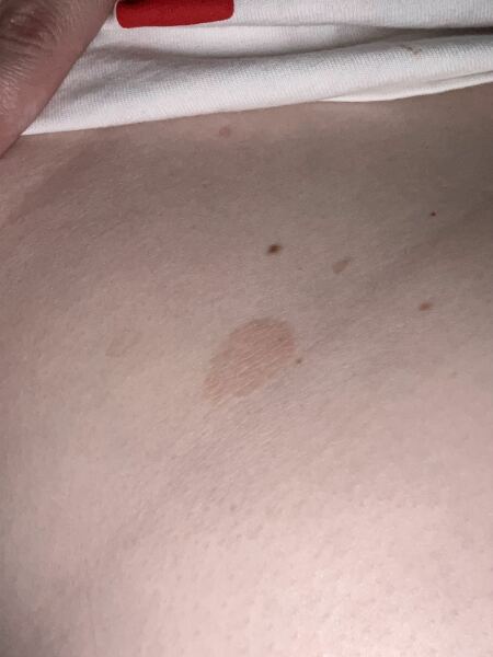Anyone know what this skin thing is? Pic included