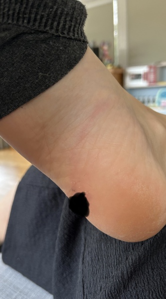 Tracking line on foot?