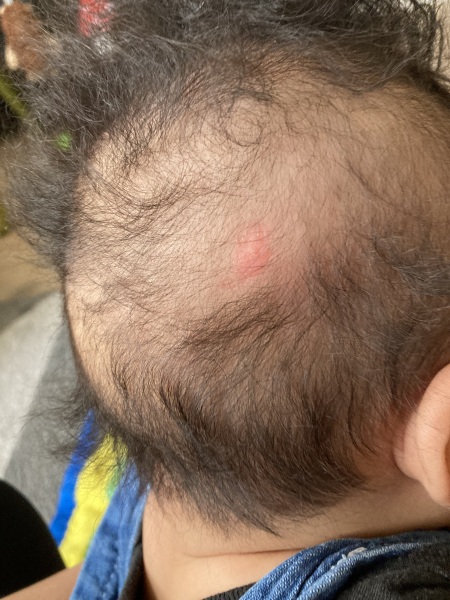 Help! What is this on baby’s scalp ??
