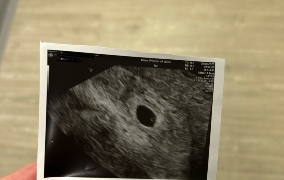 Very early scan photo