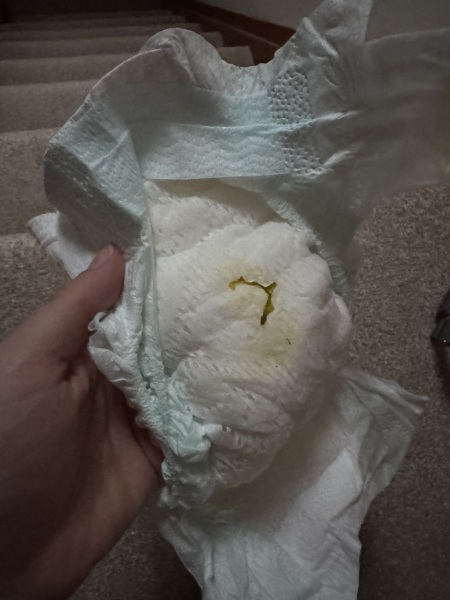 Mucus in nappy?