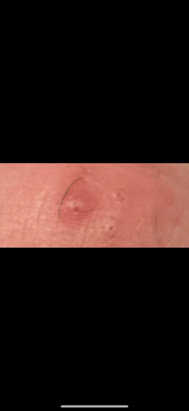 Any ideas what this is on my big toe?